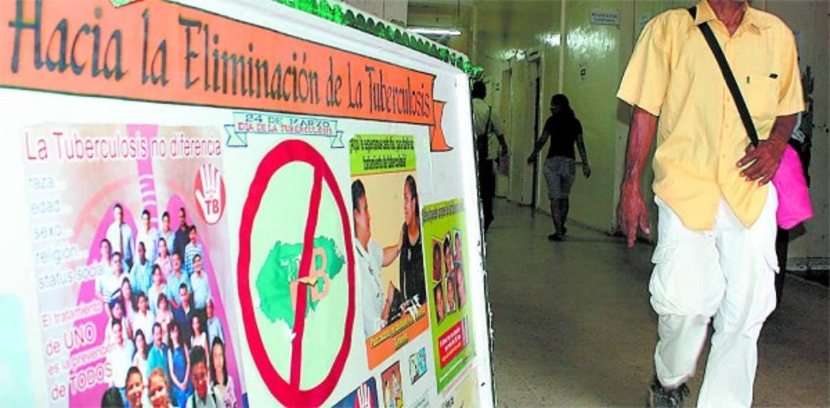 Advierten de epidemia por tuberculosis en Honduras