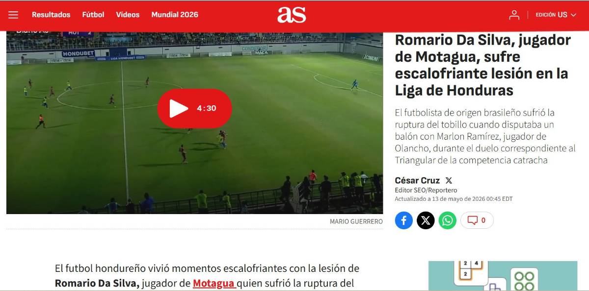 Así reaccionan los medios internacionales tras terrible lesión de Romario da Silva