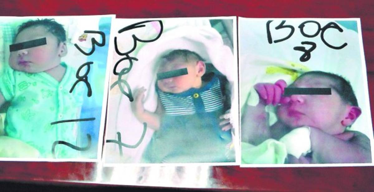 Las autoridades sanitarias presentaron las imágenes de tres de los ocho pequeñitos afectados que permanecen internos en el Hospital Regional del Sur, en Choluteca.