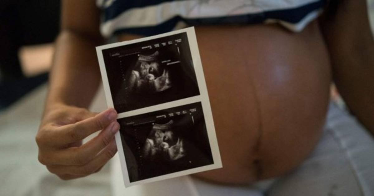 Segundo caso de microcefalia en feto asociado al zika en España