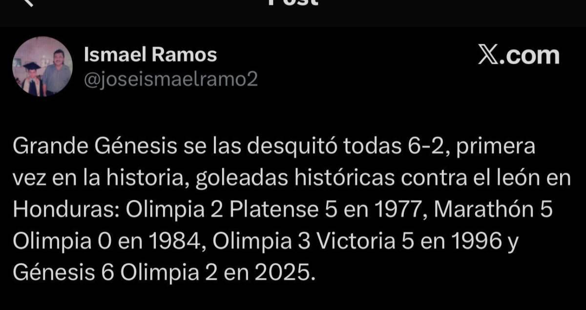 Ridiculizado Pesadilla Lo que dicen los medios tras goleada al Olimpia