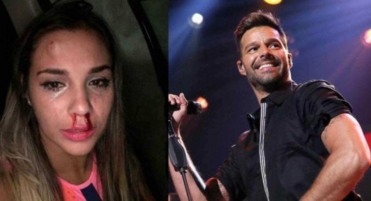 Actriz denuncia golpiza propinada por un bailarín de Ricky Martin