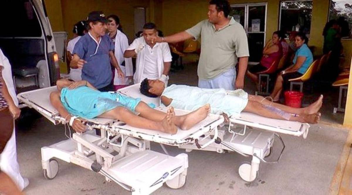 Rayo lesiona a tres niños en el norte de Honduras