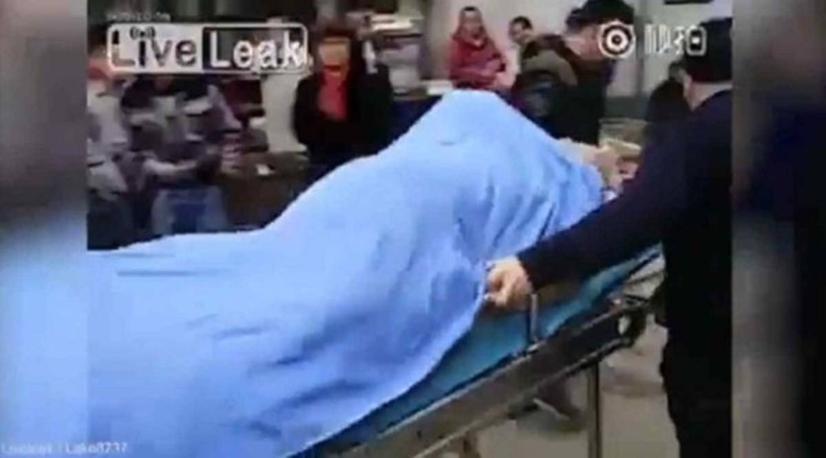 Prostituta es separada quirúrgicamente de su cliente, quien murió en pleno acto sexual