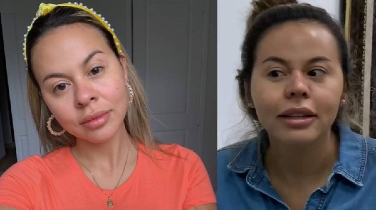 FOTOS: Antes y después de Lipstickfables tras cirugía estética