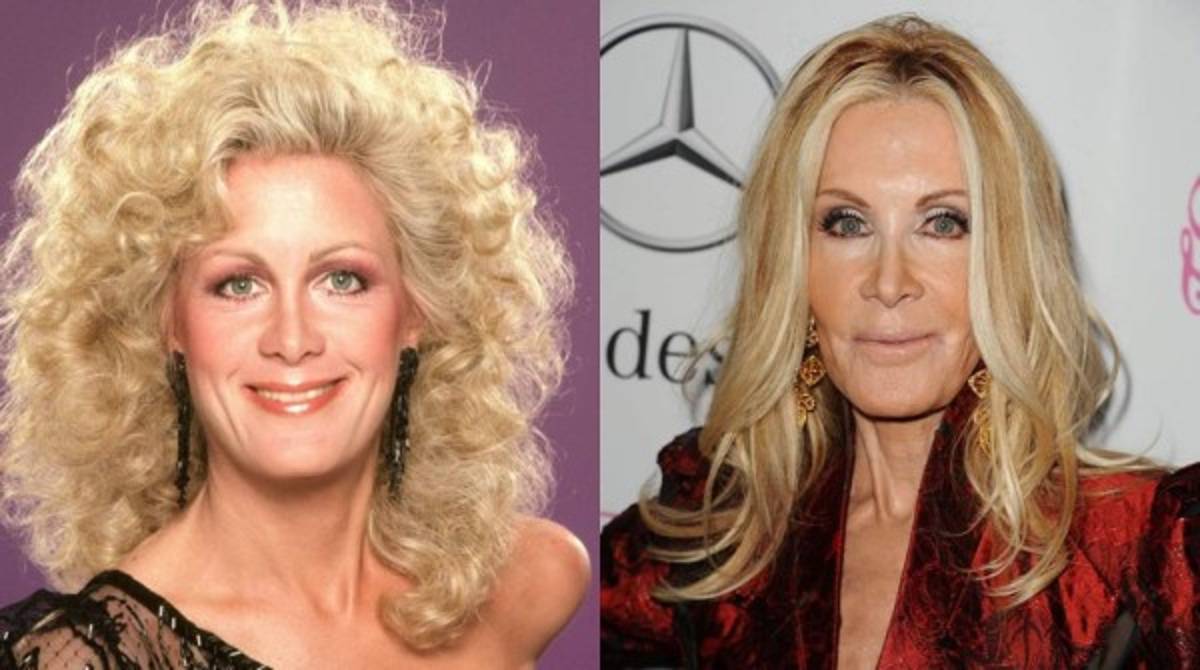 Famosos que lucen terribles después de las cirugías