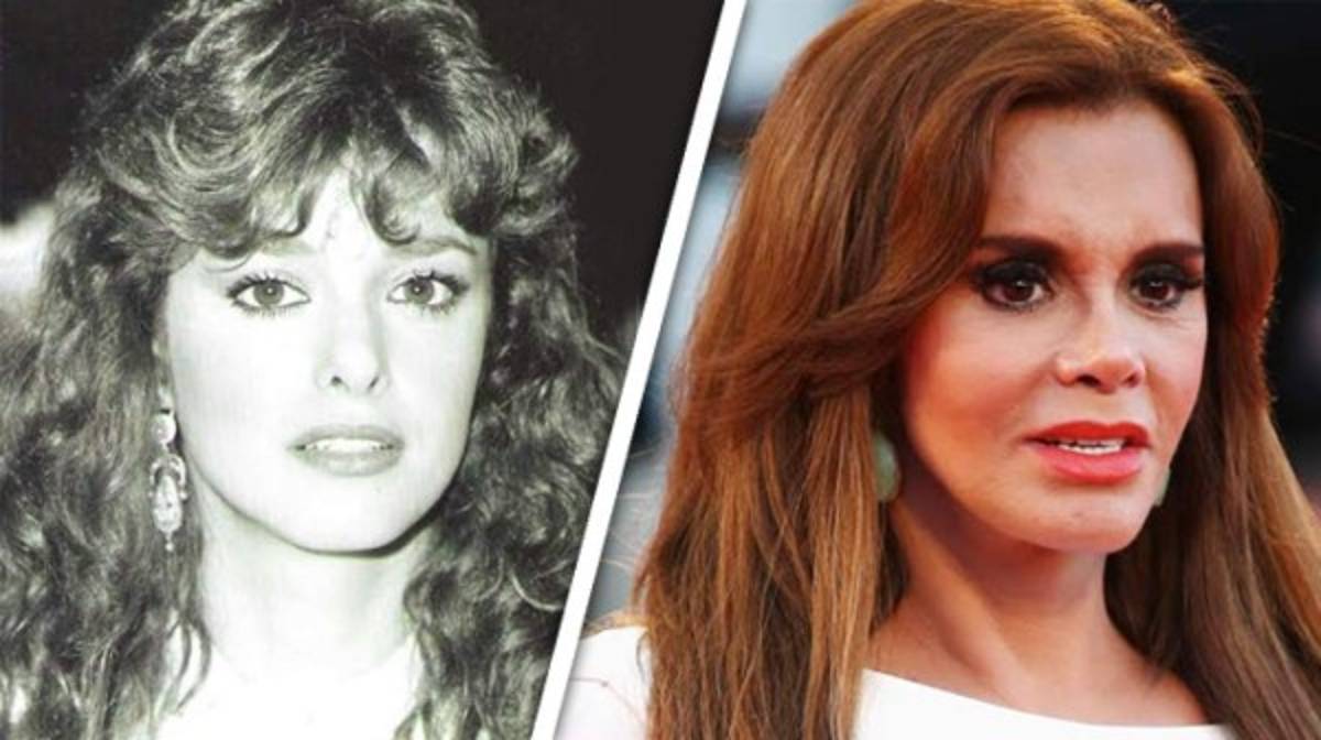 Famosos que lucen terribles después de las cirugías