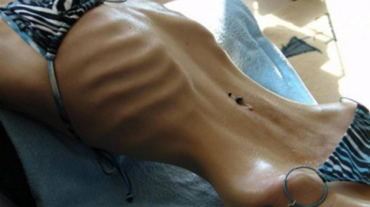 El peor de los casos