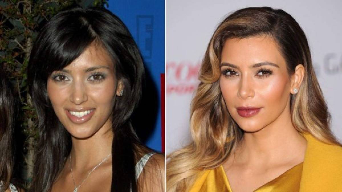Así ha cambiando el rostro de Kim Kardashian