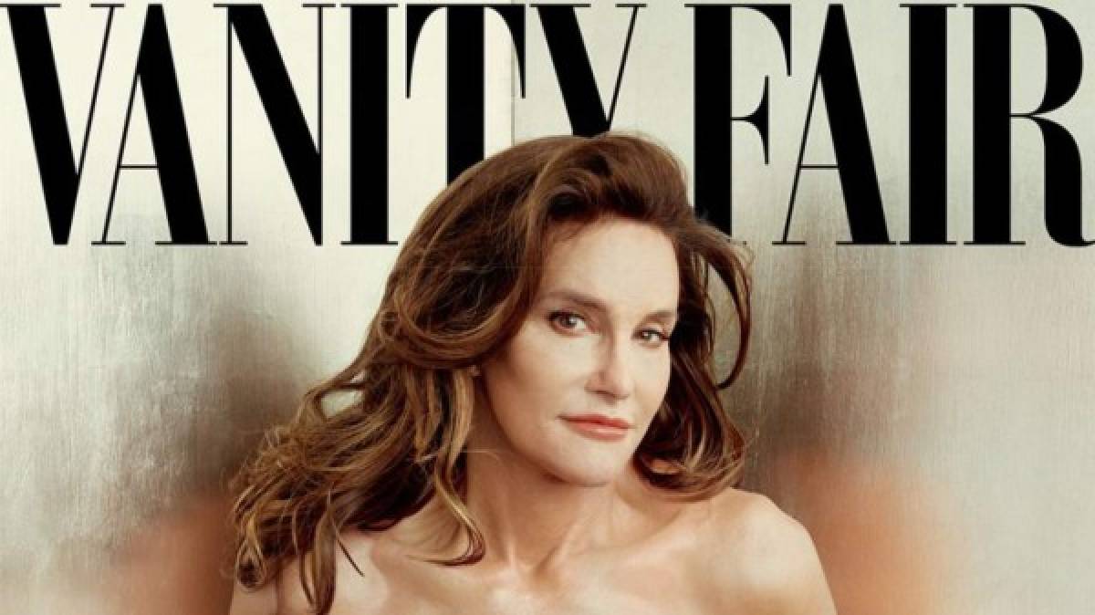 Cuánto le costó a Caitlyn Jenner su rostro de mujer