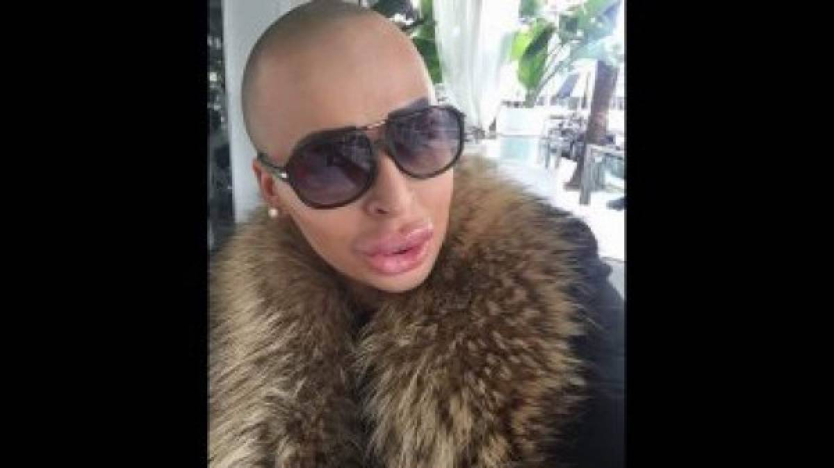 Un joven invirtió todo su dinero para parecerse a Kim Kardashian