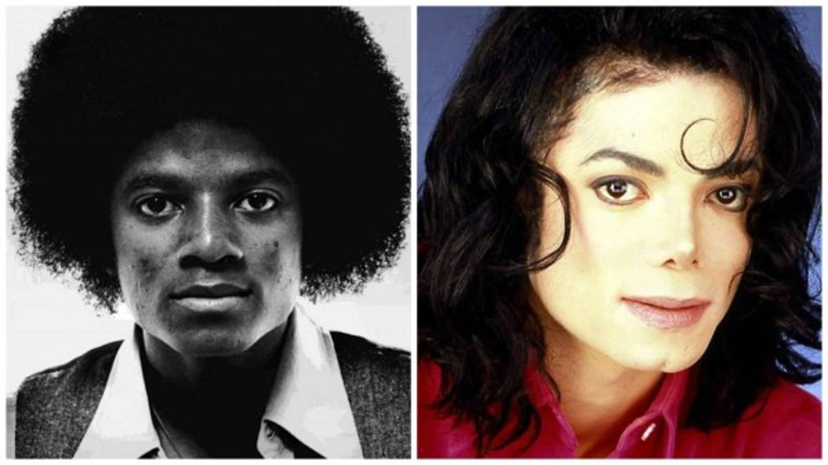 Famosos que lucen terribles después de las cirugías