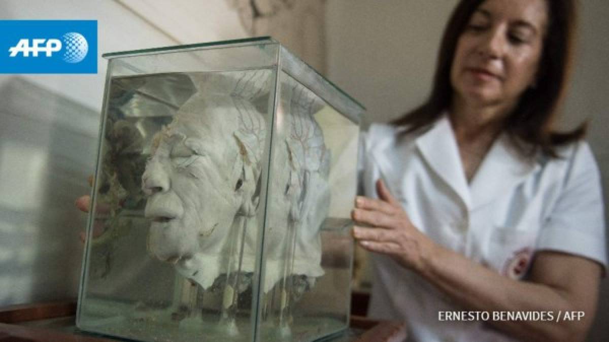 Un insólito museo invita a escudriñar el cerebro humano