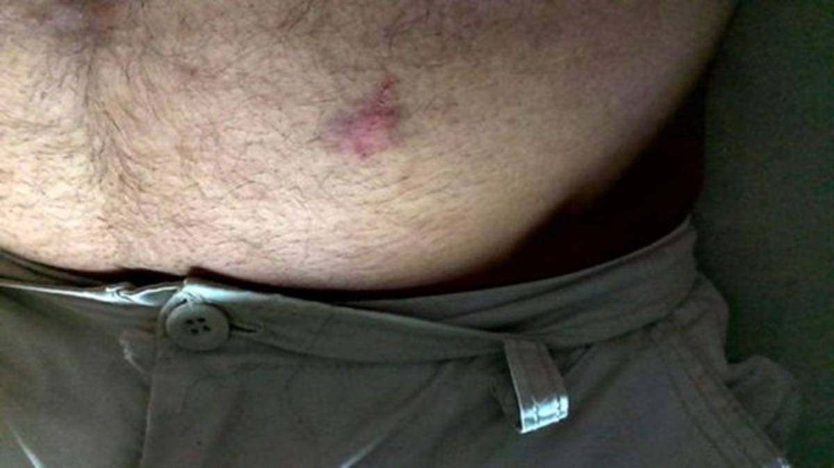 Feroz golpiza a periodista en Cuba