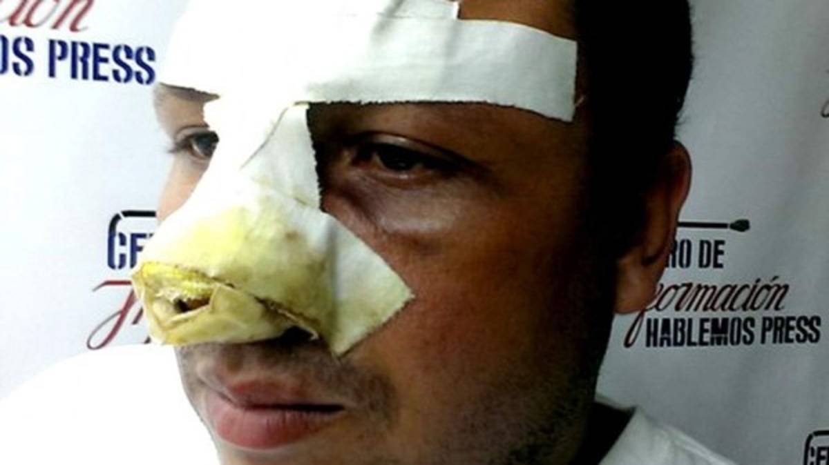 Feroz golpiza a periodista en Cuba