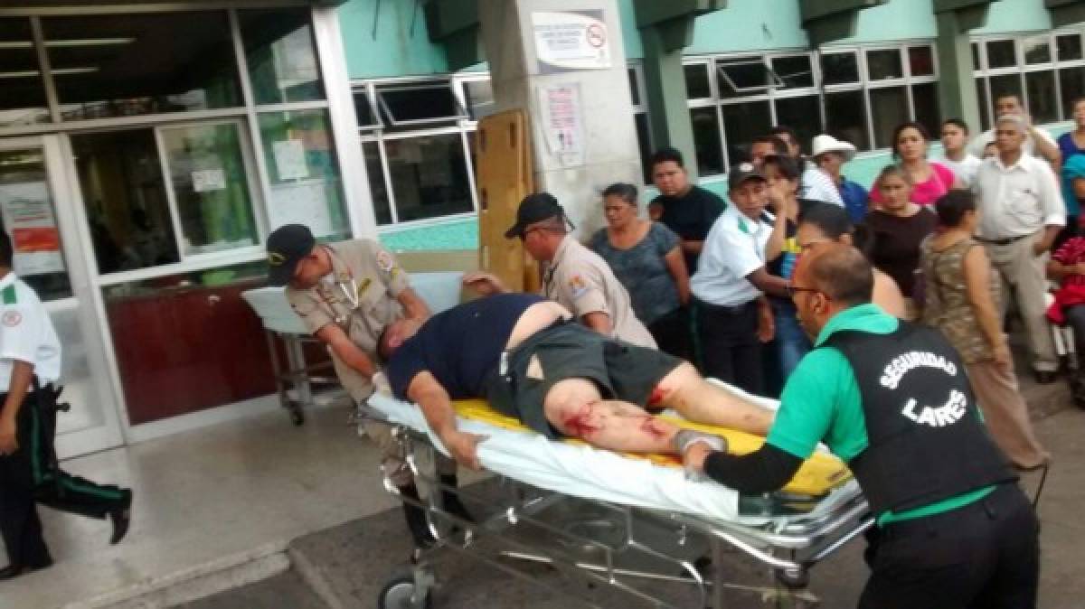 Honduras: 10 personas heridas en choque de bus rapidito contra muro  