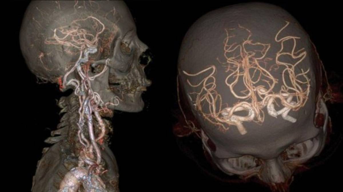 El cuerpo humano por dentro como nunca lo has visto
