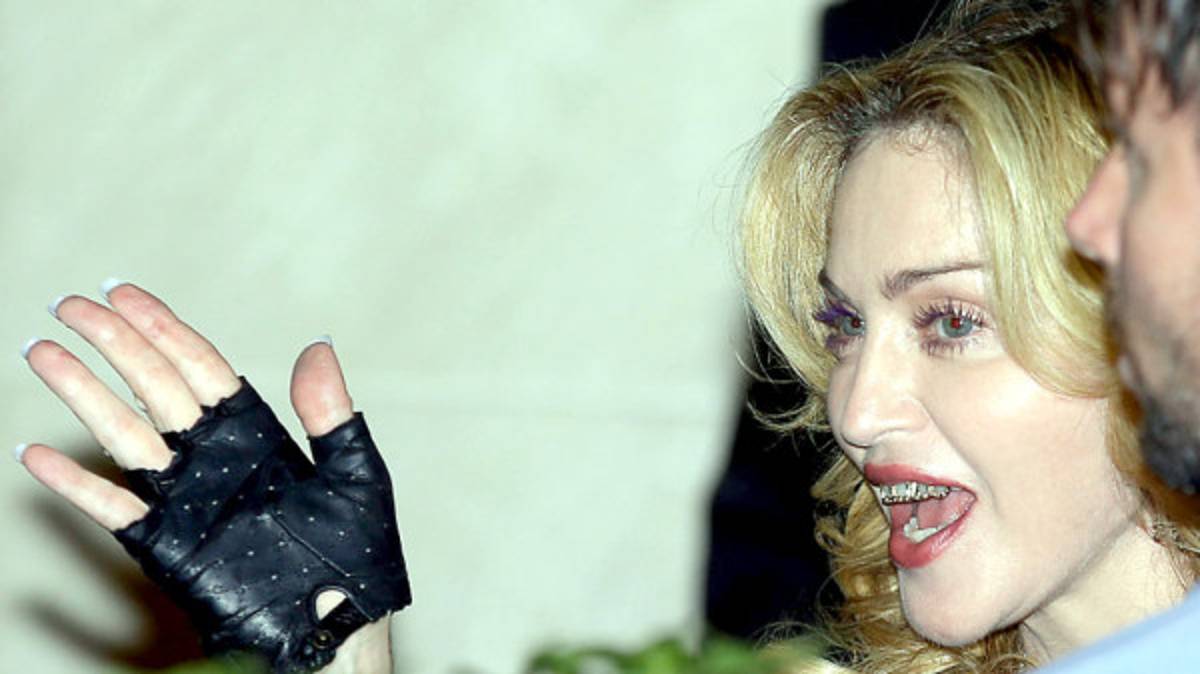 Fotos: La polémica dentadura de oro de Madonna