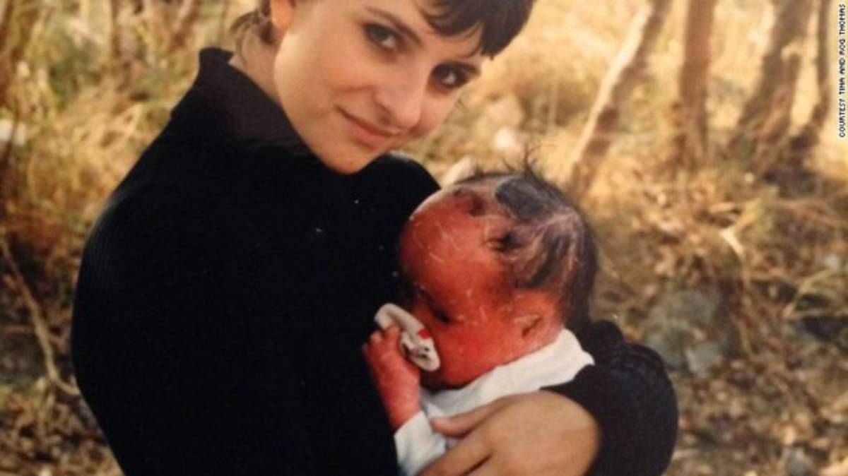 Escondió su rostro por 22 años