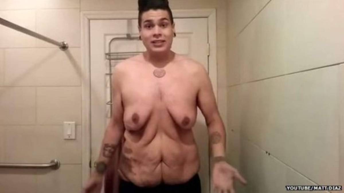 El grito de auxilio de un joven que bajó 120 kilos