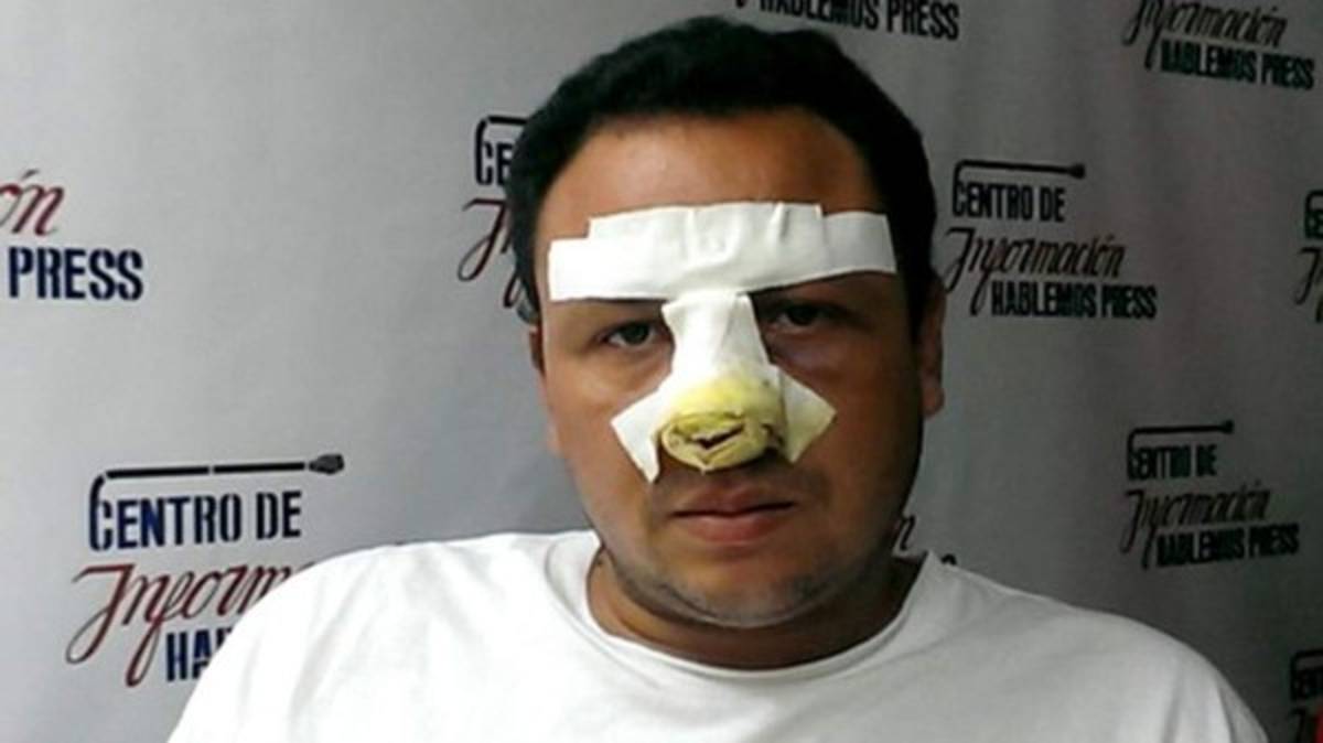 Feroz golpiza a periodista en Cuba