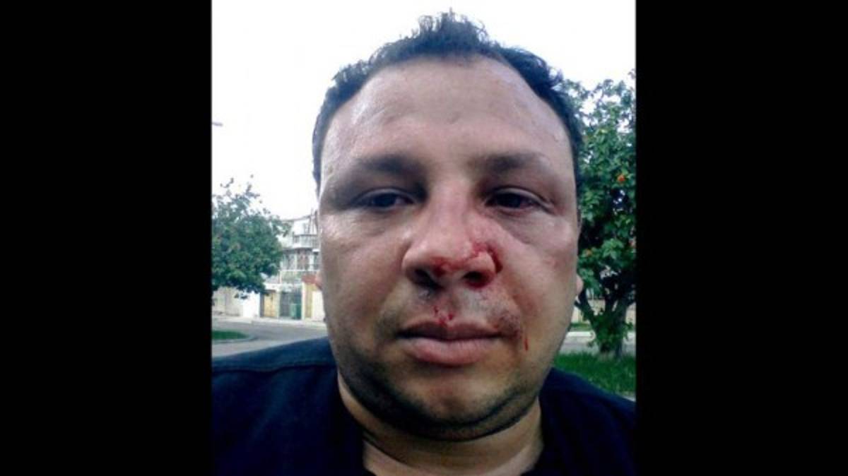 Feroz golpiza a periodista en Cuba