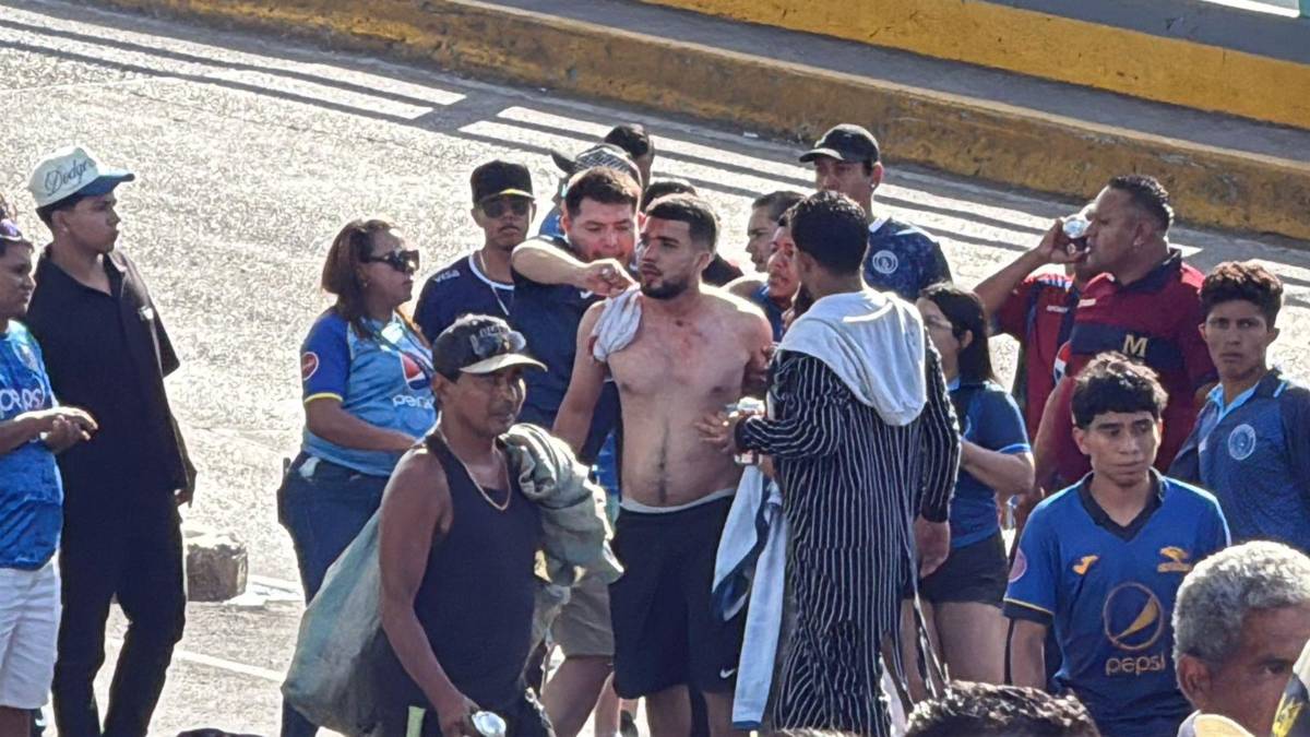 En fotos: Heridos, disparos y un caos total en las afueras del Nacional previo al Motagua vs Olimpia