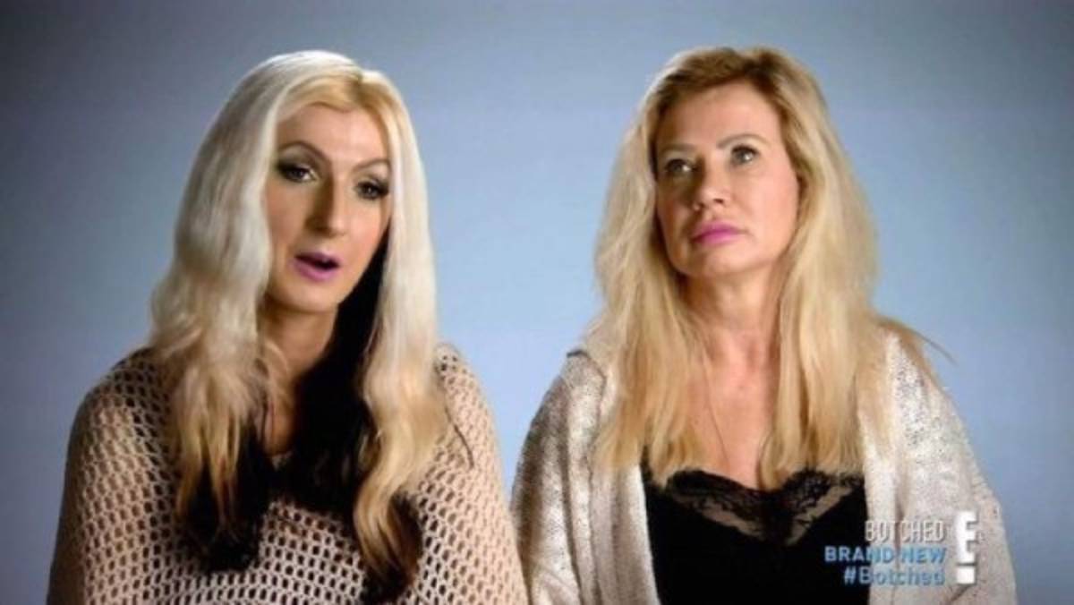 Madre se realiza más de una docena de cirugías para parecerse a su hija