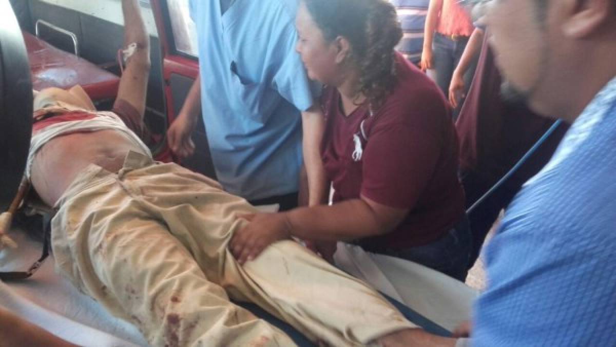 Al menos siete heridos en accidente de camión en carretera a Olancho