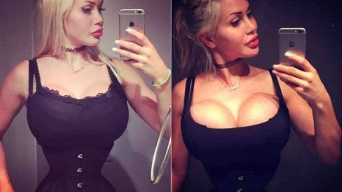 Ella se quitó seis costillas para parecer una caricatura