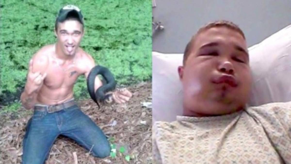 Intentó besar una víbora