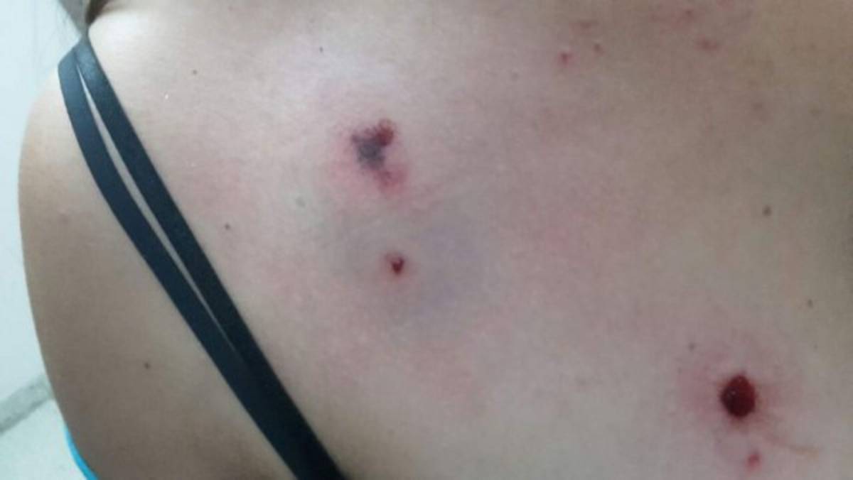 Secretaría de Seguridad investiga supuesto atentado contra periodista Jhony Lagos