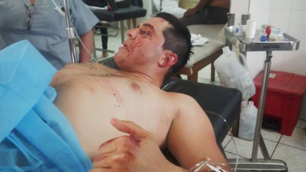 Al menos seis muertos deja masacre en el barrio Cabañas de San Pedro Sula