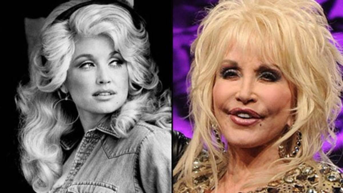 Famosos que lucen terribles después de las cirugías