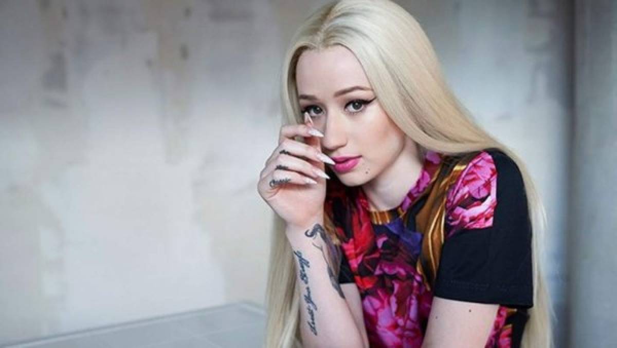 ¿Adicta a las cirugías plásticas? Iggy Azalea reaparece con nuevo rostro