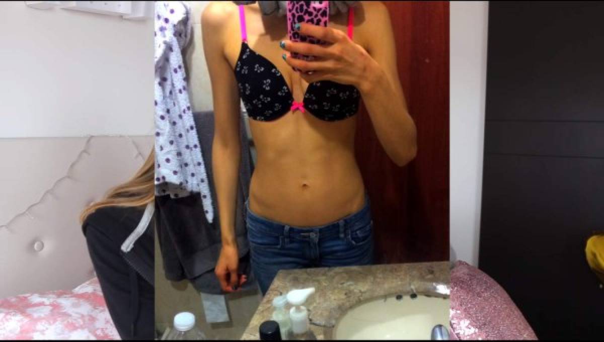 Blogguera colombiana Pautips confiesa que se recupera de la bulimia