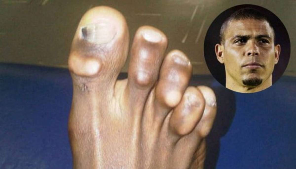 ¡Horribles! Así son los pies de las estrellas del fútbol