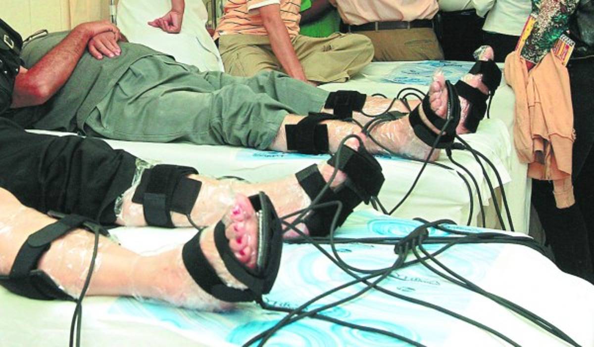 A diario dos personas sufren una amputación en el Hospital Escuela