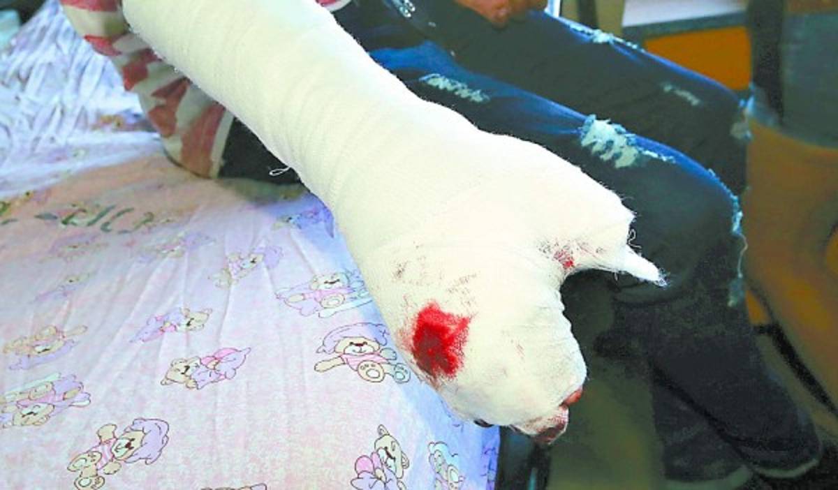 Honduras: A 17 sube número de víctimas a causa de la pólvora