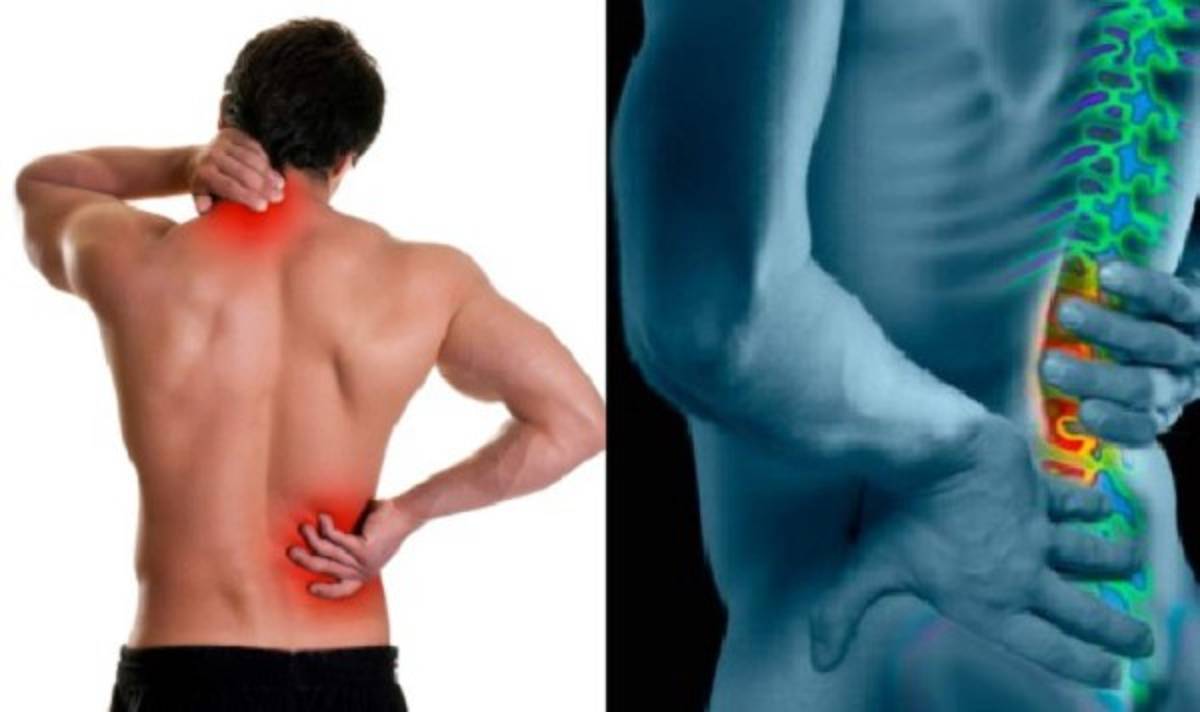 Dolores de espalda, principal causa de incapacidad en el mundo