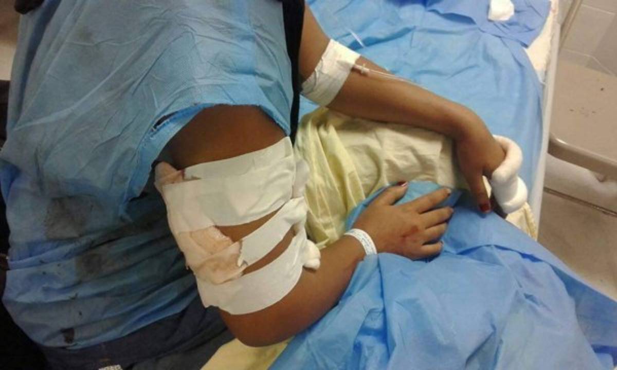 Catorce quemados por pólvora durante las fiestas