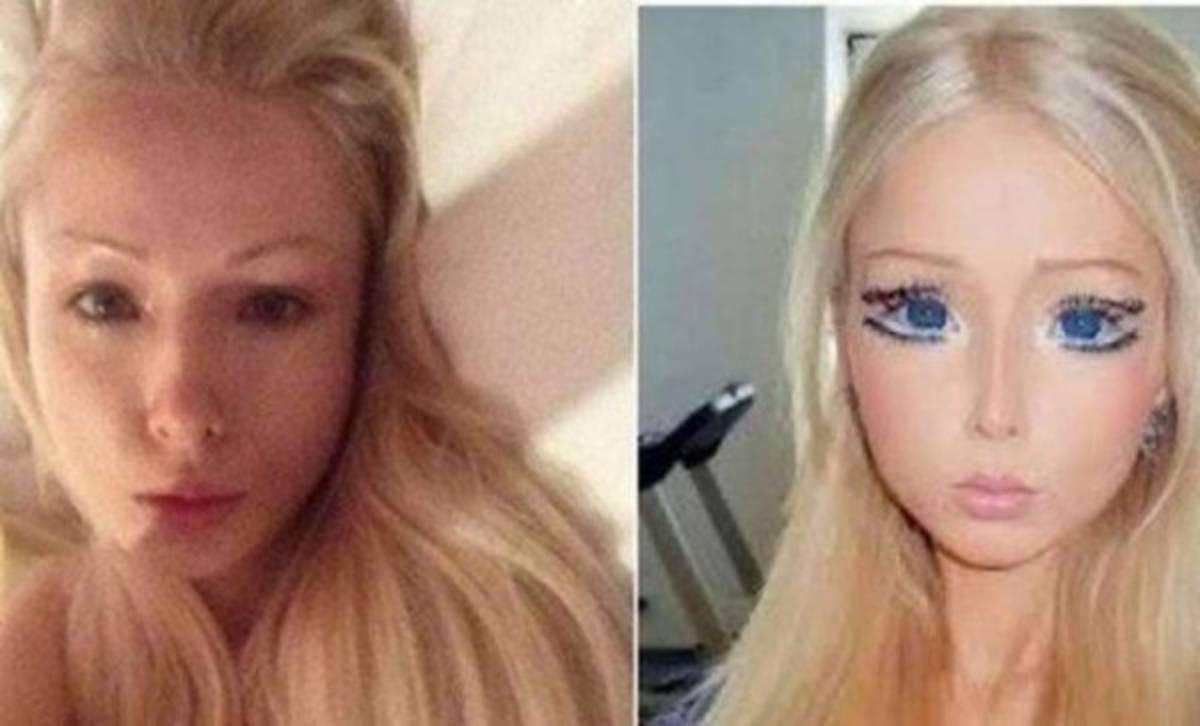Así lucía la ''Barbie humana'' antes de las cirugías