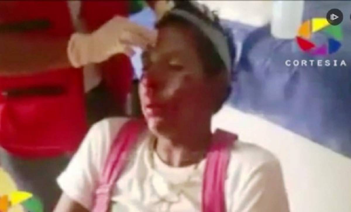 El payaso fue atendido por el personal de la Cruz Roja hondureña tras recibir la golpiza.