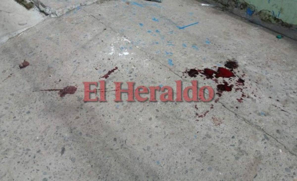 Un muerto y dos heridos tras tiroteo en mercado de Choluteca
