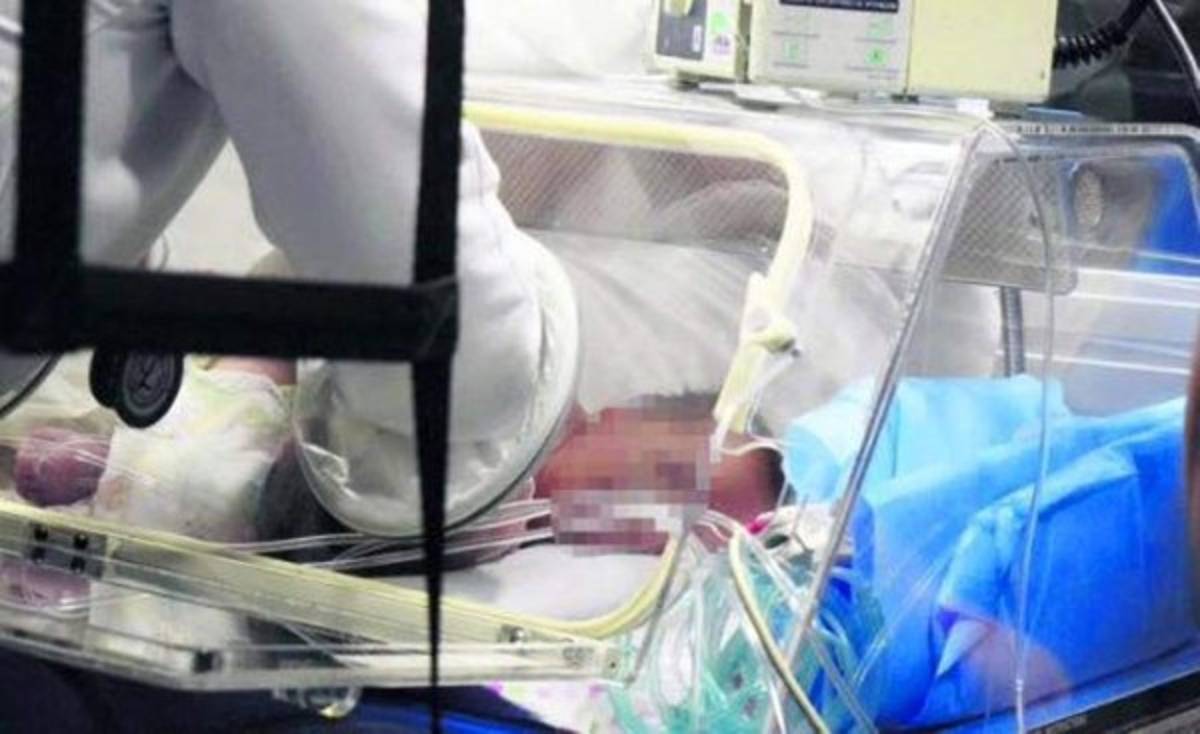 Siameses mueren a solo minutos de nacer en el Materno Infantil