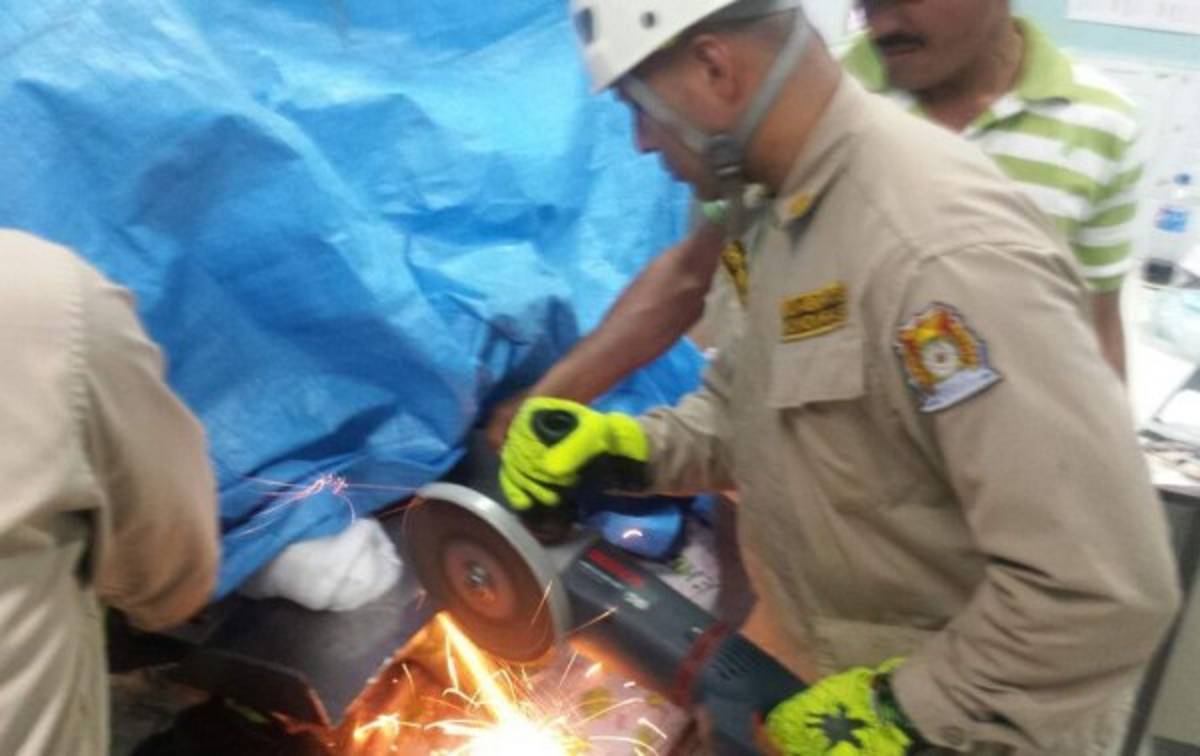 Molino eléctrico casi demuele mano derecha a un menor de edad en Comayagüela