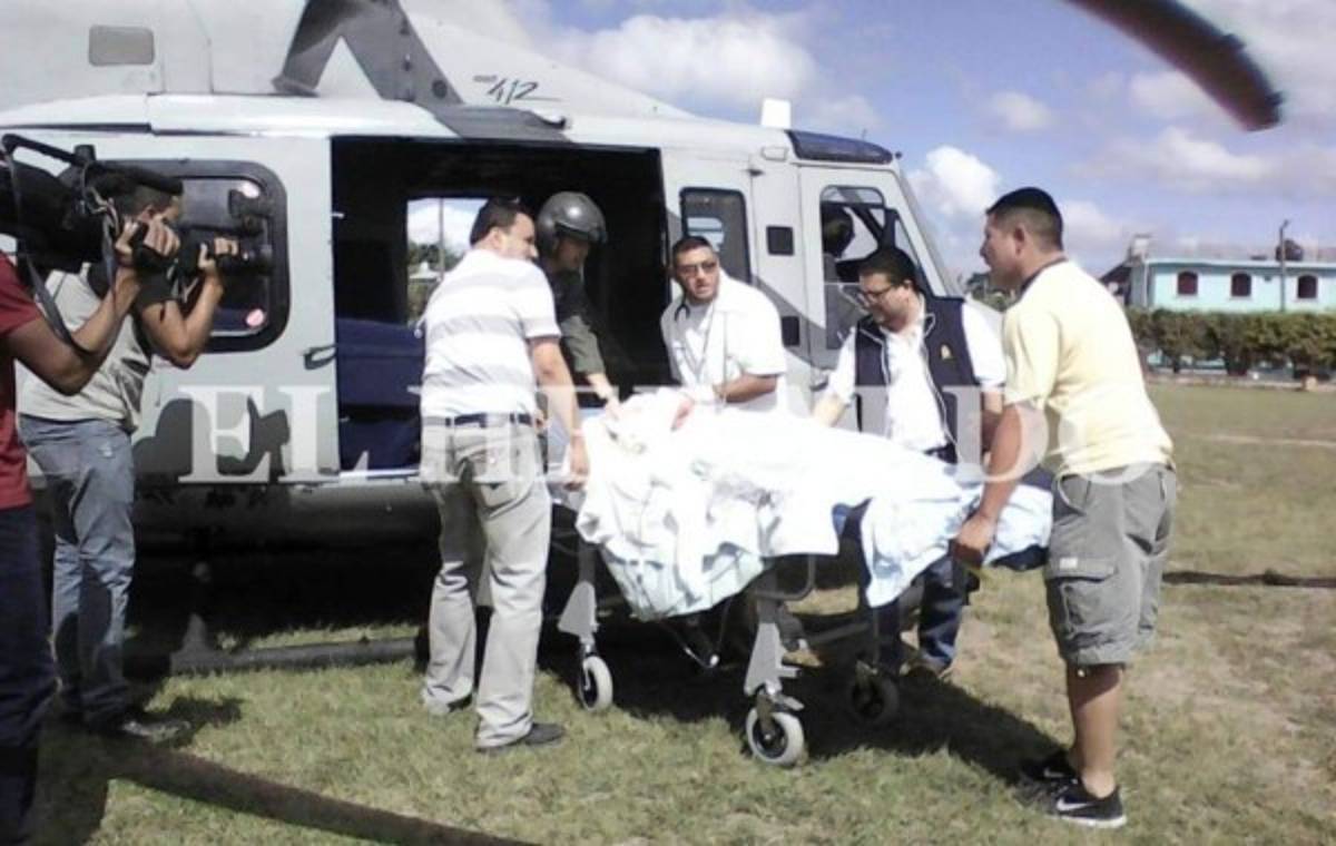 Se reporta la 15 persona quemada por pólvora