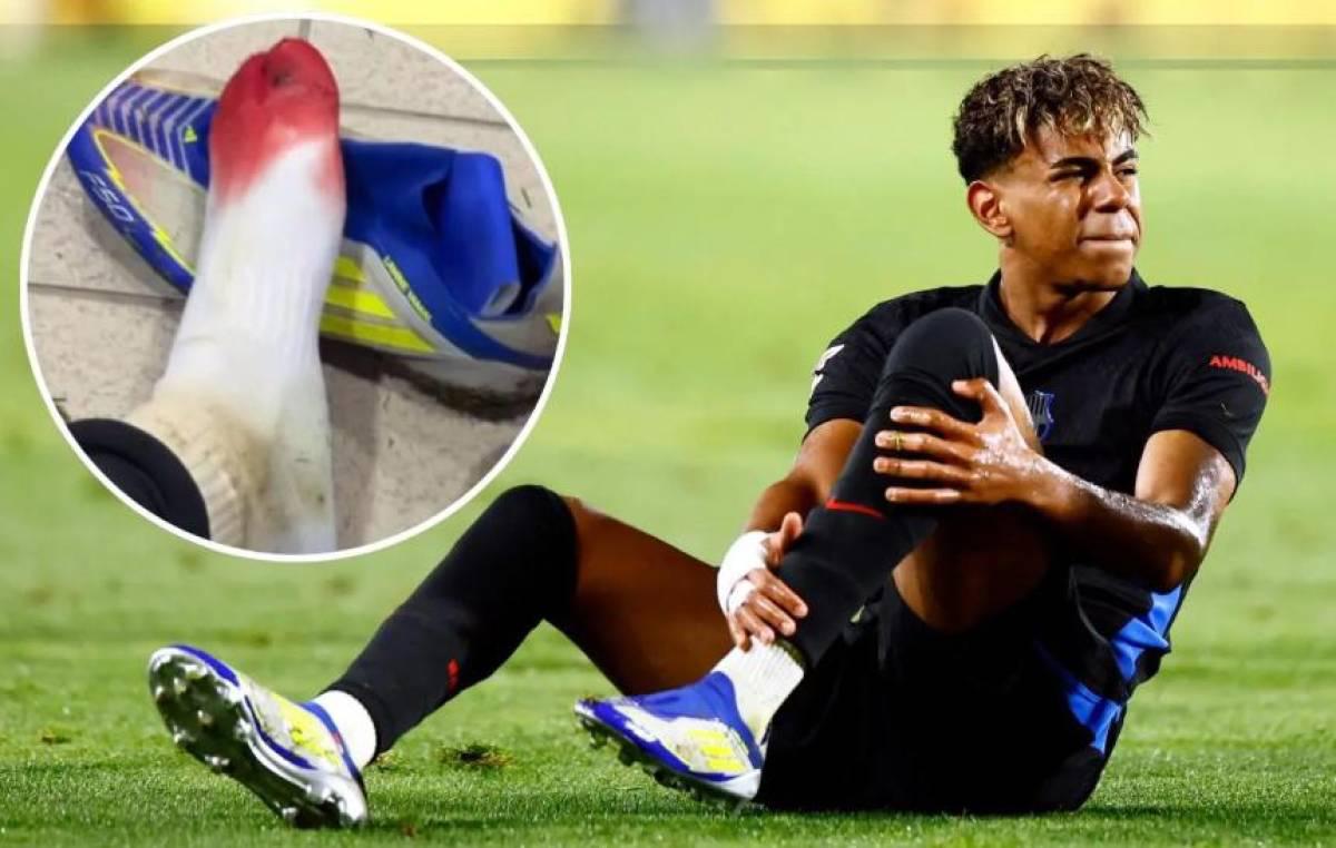 Alineación titular del Barcelona para enfrentar al Atlético de Madrid: Figura es baja