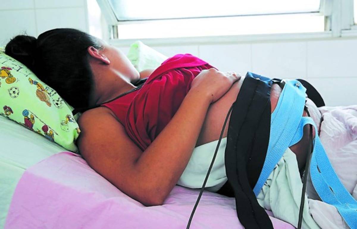 Por zika nacieron 200 niños con microcefalia en nueve meses