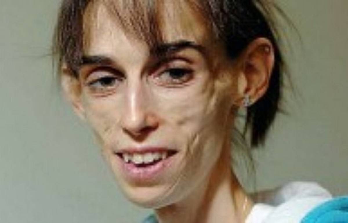 El peor de los casos